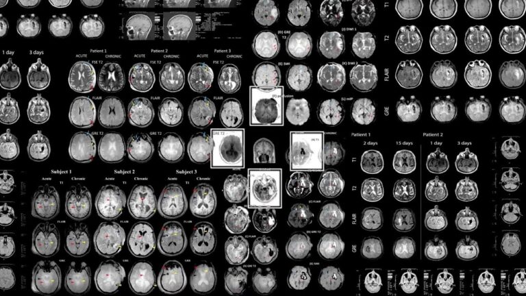 Brain scan x-rays from GAINN.