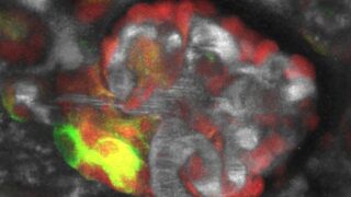 Loss of salt, body fluids may play key role in kidney regeneration